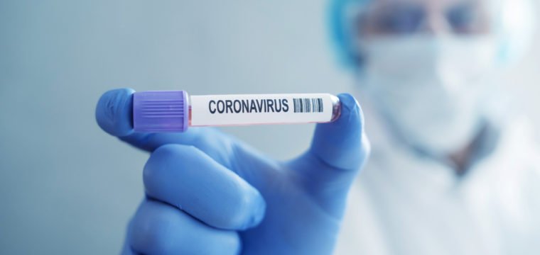 Cachoeiro realizará 17 mil testes para identificar contato com coronavírus