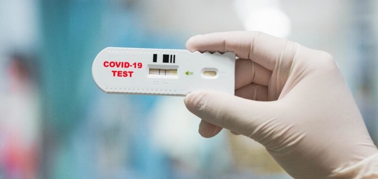 Espírito Santo realizou 9.419 testes RT PCR para detecção de Covid-19