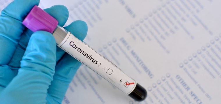 As ações da Semus para combater a pandemia em Cachoeiro
