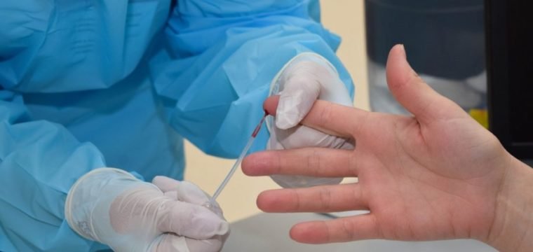 Coronavírus: Cachoeiro recebe nova fase de inquérito sorológico