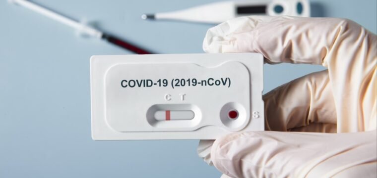 Sesi ES oferece testes rápidos de Covid-19 para os capixabas com desconto