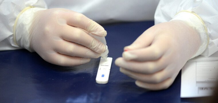 Unimed Sul mantém serviço de testagem gratuito  para diagnóstico de Covid-19 na população